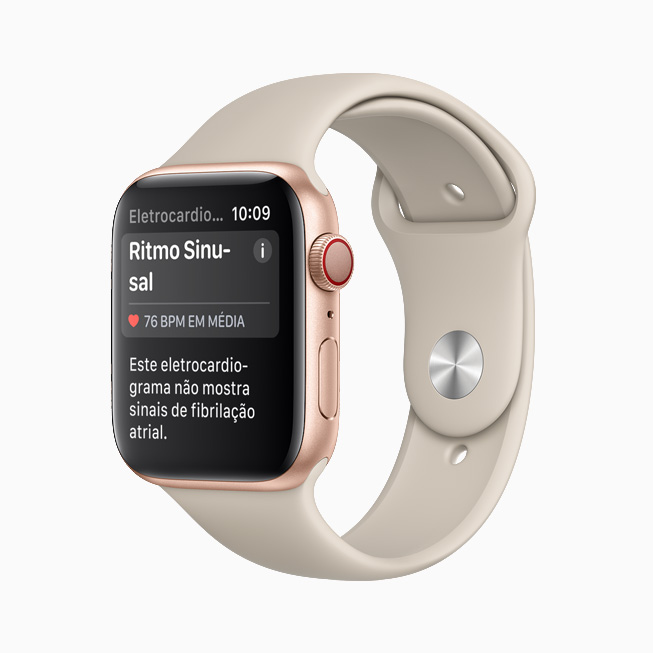 Notificação de ritmo sinusal no app ECG do Apple Watch. 