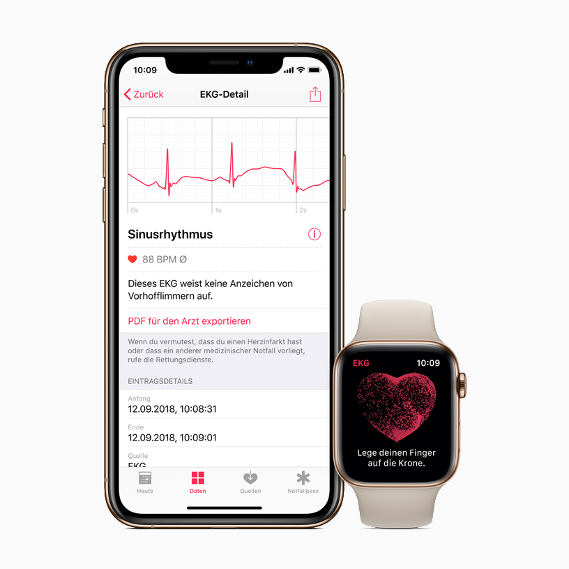 Health App auf iPhone und Apple Watch.