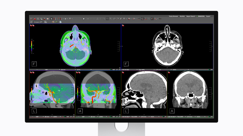 DICOM medical imaging is shown on Studio Display XDR.