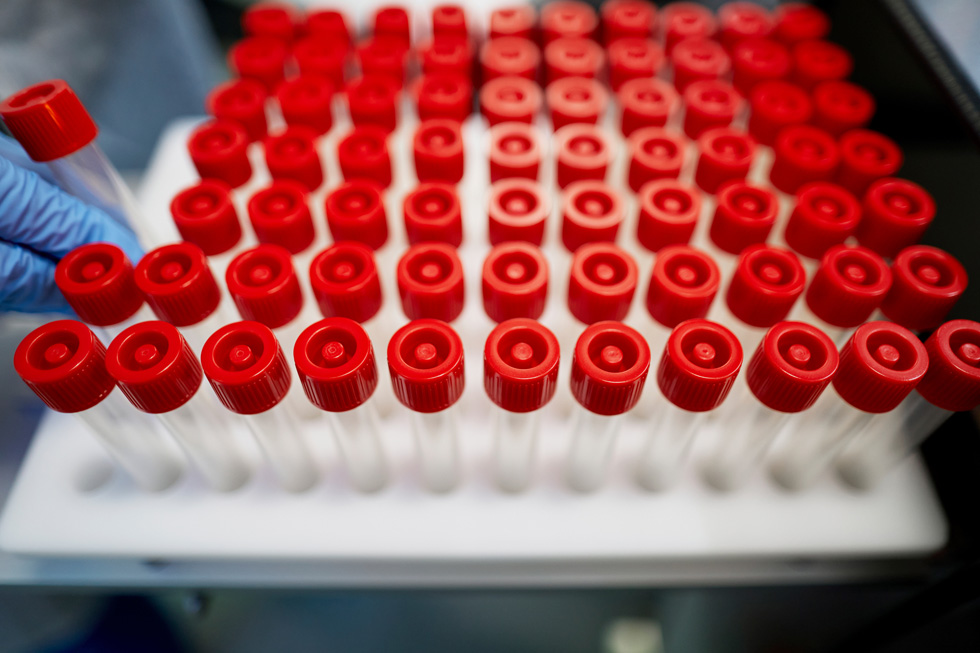 A tray of vials, part of COPAN Diagnostics’s sample collection kits.