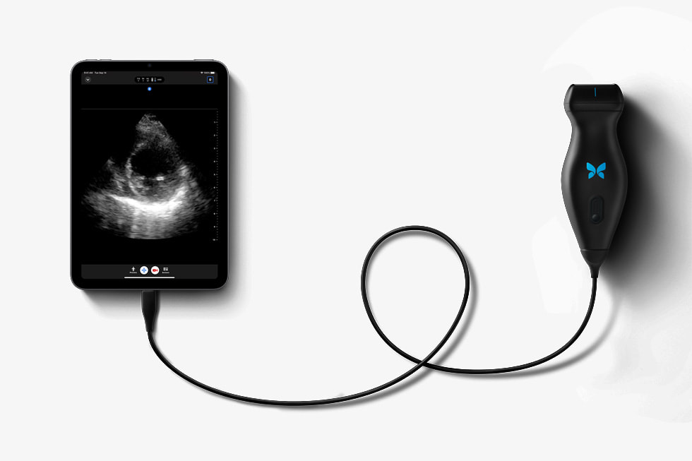 Sonde échographique branchée sur le port USB-C de l’iPad mini.