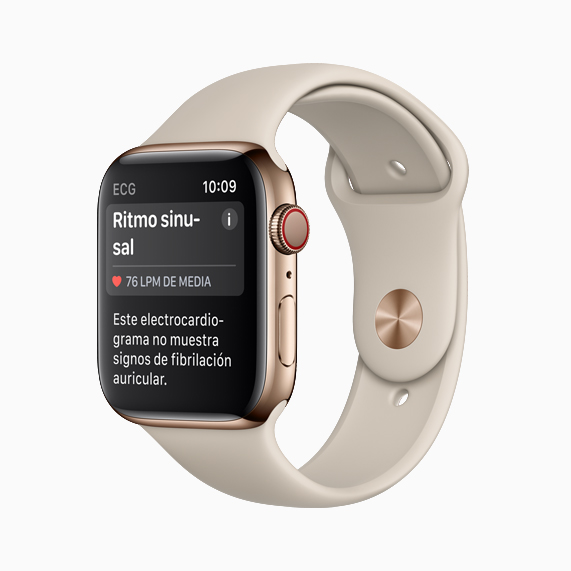 Apple Watch showing sinus rhythm.