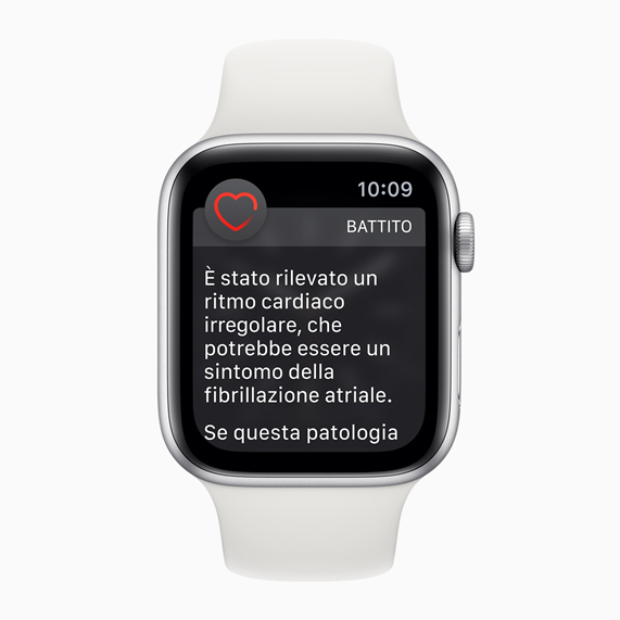 Quadrante di Apple Watch con una notifica di ritmo cardiaco irregolare.
