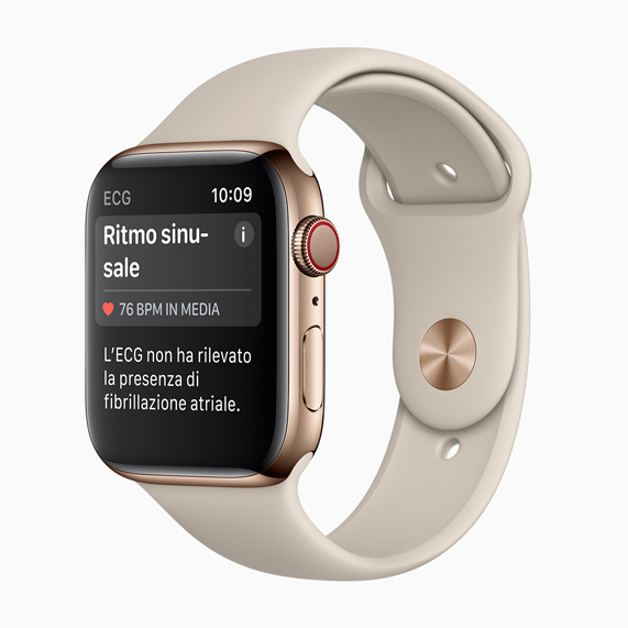 Apple Watch Series 4 con un ritmo sinusale.