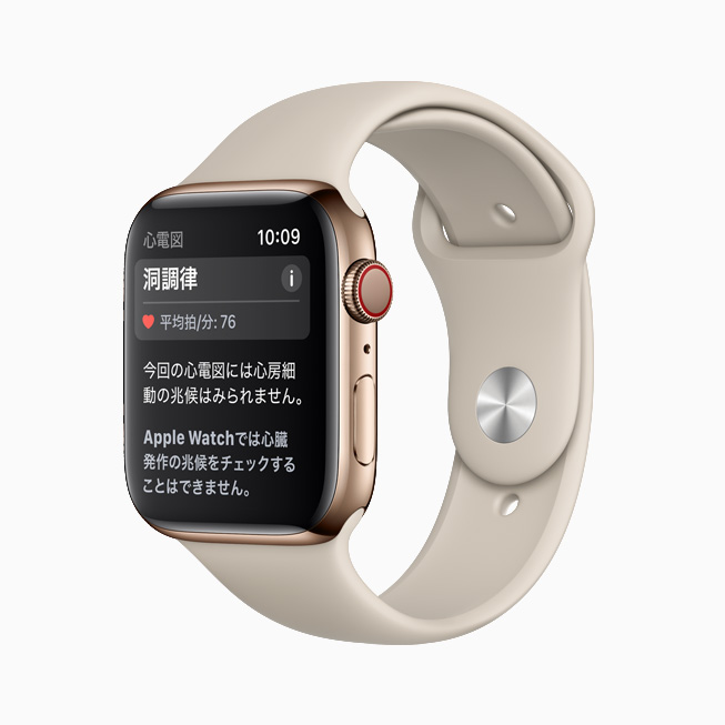 Apple Watch Series 6上の心電図アプリケーションに表示されている洞調律の分類。 