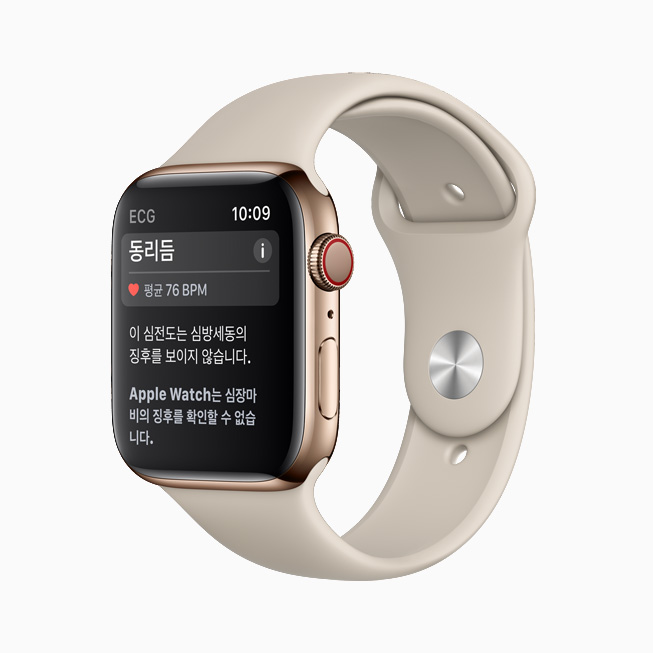 Apple Watch의 심전도 앱에 표시된 정상박동(Sinus Rhythm) 알림.