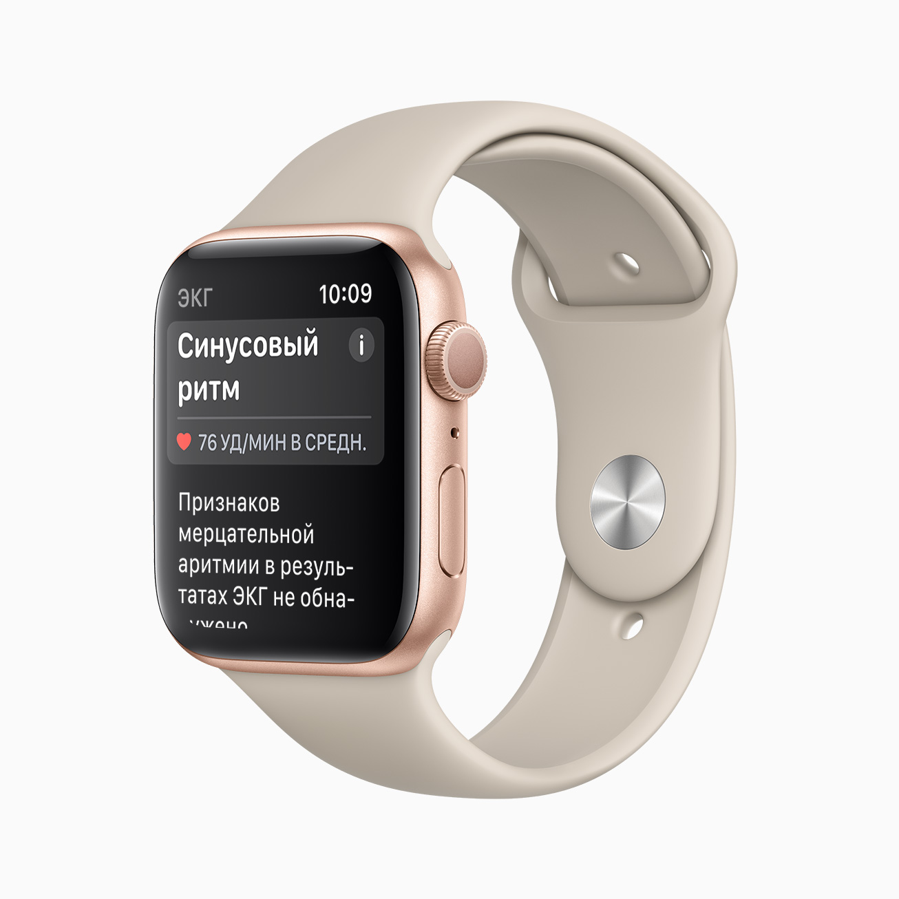 На дисплее Apple Watch отображается уведомление о синусовых ритмах.
