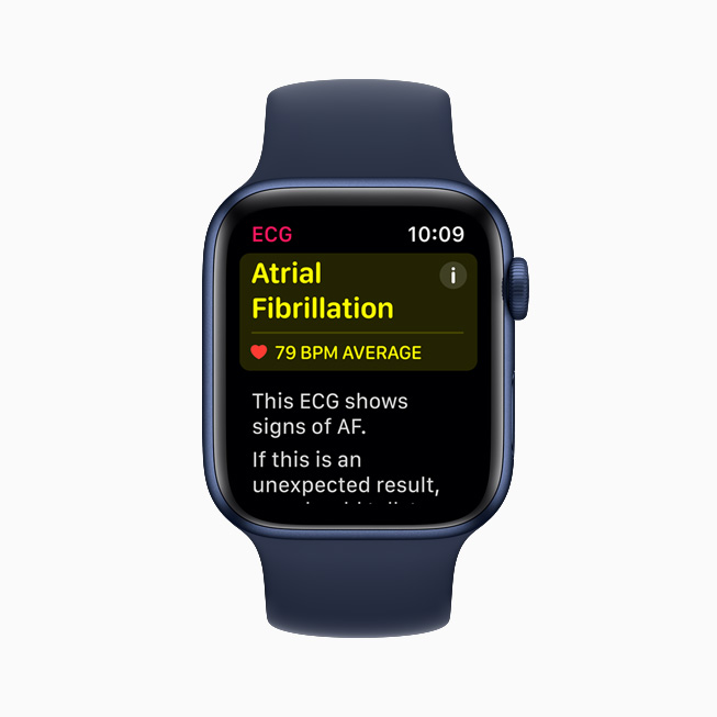 AFib classification displayed in the ECG app on Apple Watch Series 6.
