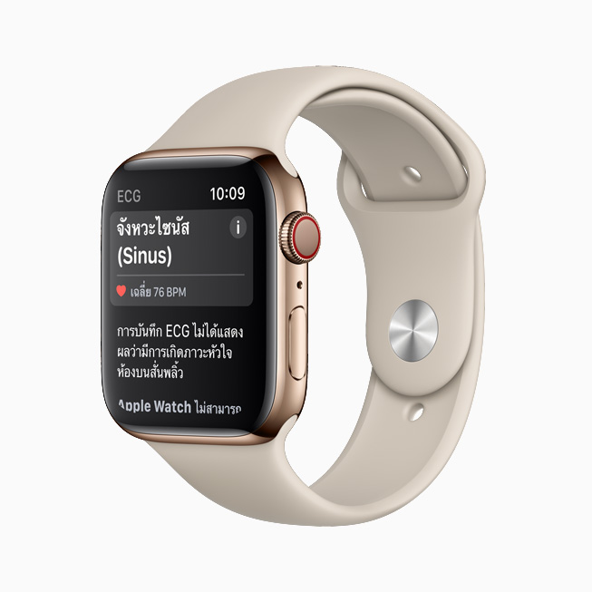 แอพ ECG บน Apple Watch Series 6 แสดงการจัดประเภทเป็นจังหวะไซนัส 