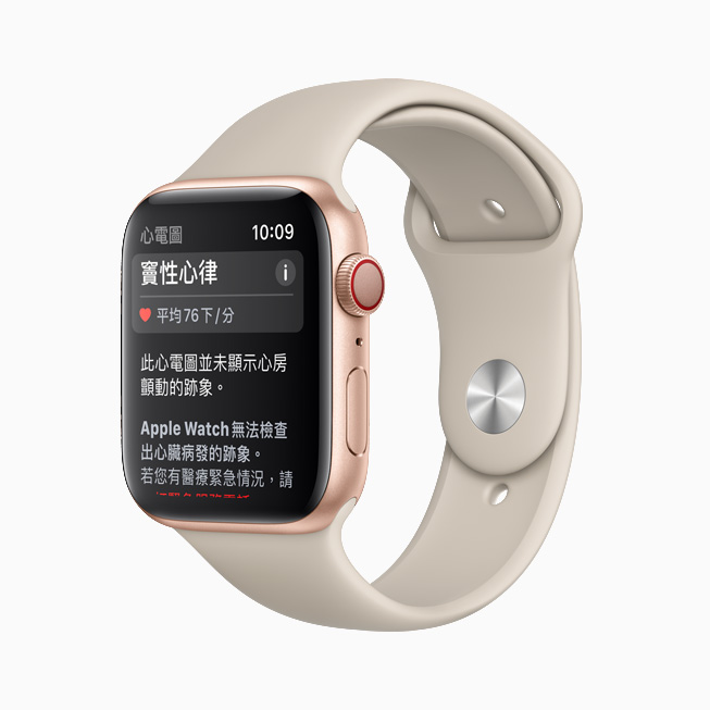 顯示在 Apple Watch 上「心電圖」app 中的竇性心律分類。 