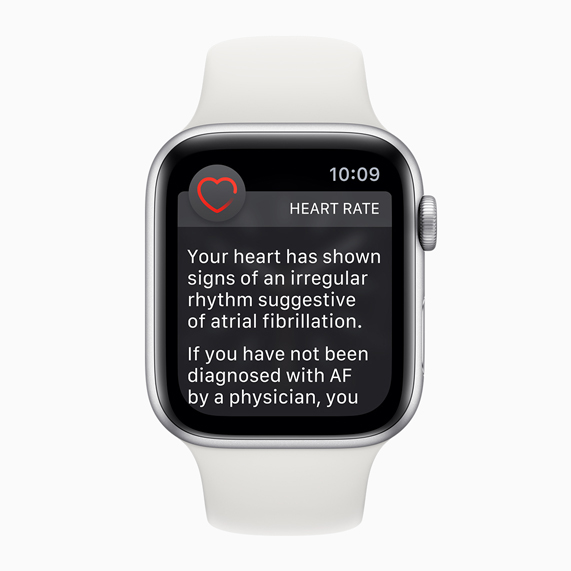 Wijzerplaat van Apple Watch met melding van onregelmatig hartritme.