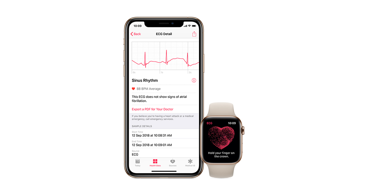 ECG app and irregular heart rhythm 