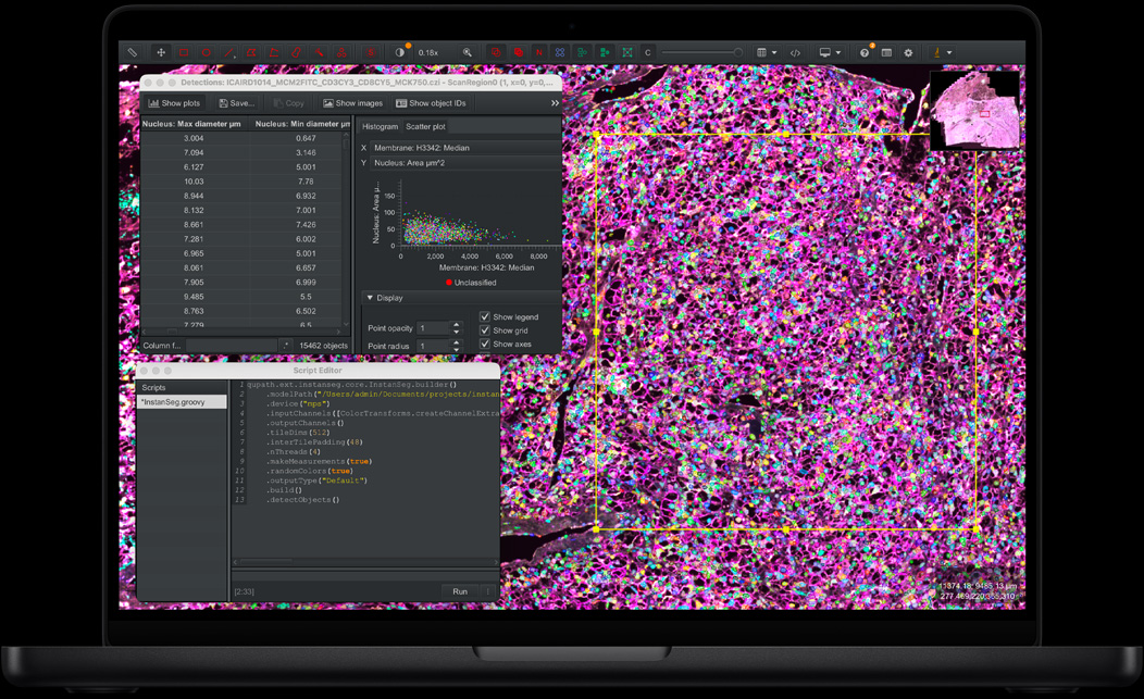 Pantalla de una MacBook Pro que muestra QuPath e Instanseg